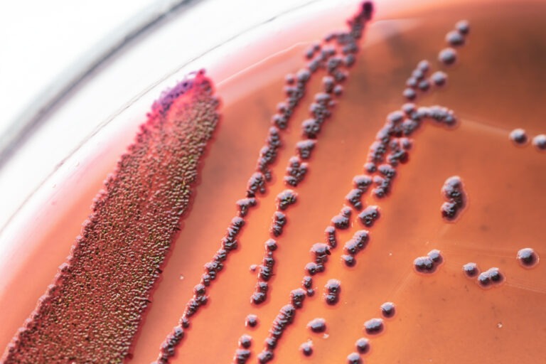 About us | Antimicrobial Resistance (AMR) Action