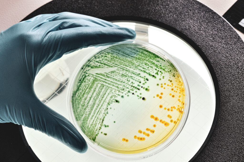 Antimicrobial resistance (AMR) E.coli bacteria growing in dish.