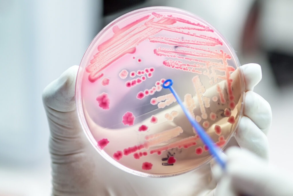 Antimicrobial resistance tests conducted in a petri dish.