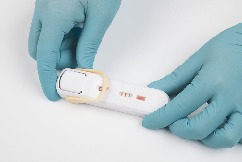 FebriDx is an Australian diagnostic that analyses a blood sample from a finger prick.