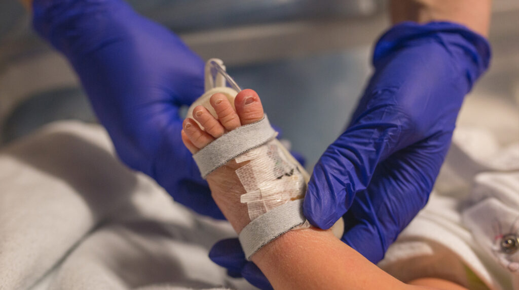 A newborn baby receiving treatment in a hospital setting