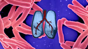 Tuberculosis image set behind a stylised illustration of human lungs